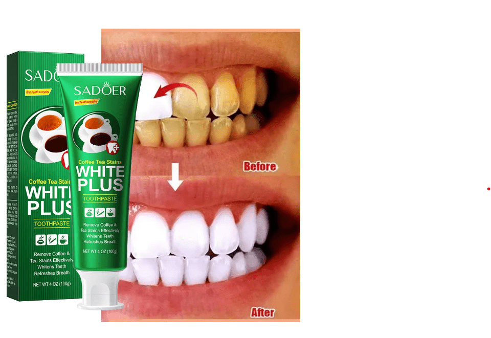 Teeth Whitening Toothpaste (100g)